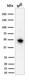 Anti-CD79a antibody [JCB117] used in Western Blot (WB). GTX34556