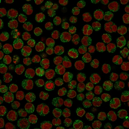 Anti-CD79a antibody [SPM549] used in Immunocytochemistry/ Immunofluorescence (ICC/IF). GTX34557