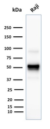 Anti-CD79a antibody [SPM549] used in Western Blot (WB). GTX34557