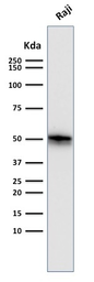 Anti-CD79a antibody [SPM550] used in Western Blot (WB). GTX34558