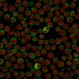 Anti-CD79a antibody [IGA/515] used in Immunocytochemistry/ Immunofluorescence (ICC/IF). GTX34560