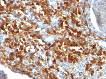 Anti-CD79a antibody [IGA/515] used in IHC (Paraffin sections) (IHC-P). GTX34560