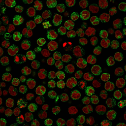 Anti-CD79a antibody [HM47/A9] used in Immunocytochemistry/ Immunofluorescence (ICC/IF). GTX34563