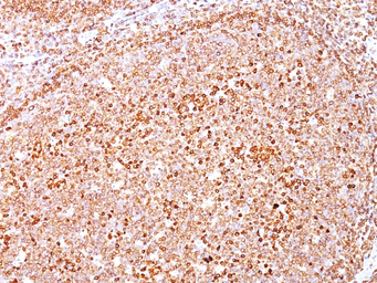 Anti-CD79a antibody [HM47/A9] used in IHC (Paraffin sections) (IHC-P). GTX34563