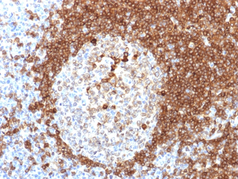 Anti-CD79a antibody [HM57] used in IHC (Paraffin sections) (IHC-P). GTX34564