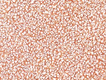 Anti-CD99 antibody [SPM586] used in IHC (Paraffin sections) (IHC-P). GTX34572