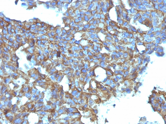 Anti-CD99 antibody [MIC2/877] used in IHC (Paraffin sections) (IHC-P). GTX34573