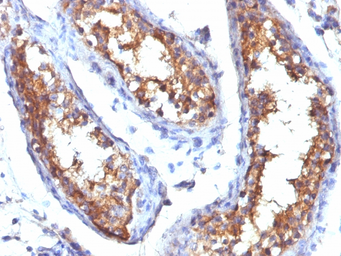 Anti-CD99 antibody [HO36-1.1] used in IHC (Paraffin sections) (IHC-P). GTX34576