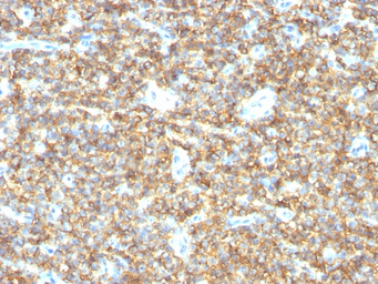 Anti-CD99 antibody [HO36-1.1] used in IHC (Paraffin sections) (IHC-P). GTX34576