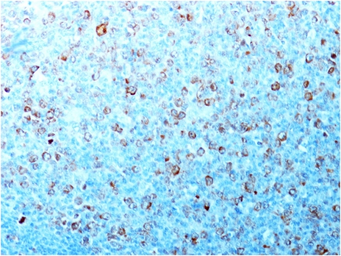 Anti-CDC2 antibody [CDK1/873] used in IHC (Paraffin sections) (IHC-P). GTX34577