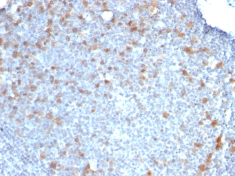 Anti-CDC20 antibody [CDC20/1102] used in IHC (Paraffin sections) (IHC-P). GTX34579