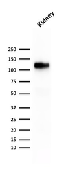Anti-CDH16 antibody [rCDH16/1071] used in Western Blot (WB). GTX34582