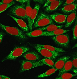 Anti-CDw75 antibody [LN-1] used in Immunocytochemistry/ Immunofluorescence (ICC/IF). GTX34584