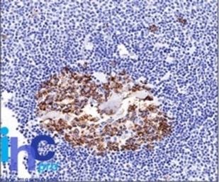 Anti-CDw75 antibody [LN-1] used in IHC (Paraffin sections) (IHC-P). GTX34584