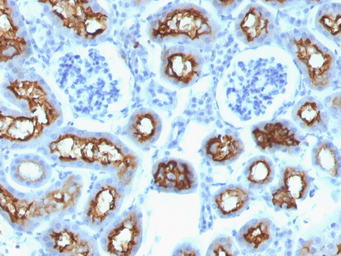 Anti-CFTR antibody [CFTR/1342] used in IHC (Paraffin sections) (IHC-P). GTX34587