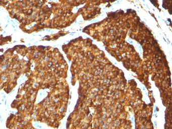 Anti-Chromogranin A antibody [CHGA/777] used in IHC (Paraffin sections) (IHC-P). GTX34598