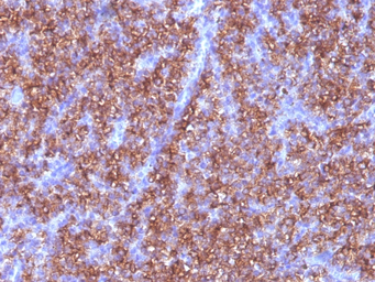 Anti-Chromogranin A antibody [CGA/413] used in IHC (Paraffin sections) (IHC-P). GTX34600