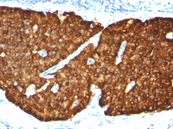 Anti-Chromogranin A antibody [CGA/413] used in IHC (Paraffin sections) (IHC-P). GTX34600