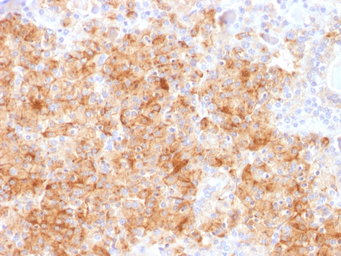Anti-Chromogranin A antibody [CHGA/1731R] used in IHC (Paraffin sections) (IHC-P). GTX34601