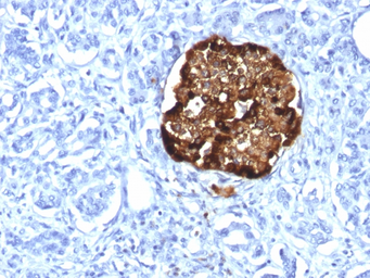 Anti-Chromogranin A antibody [CHGA/1815R] used in IHC (Paraffin sections) (IHC-P). GTX34603