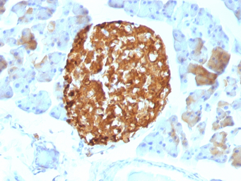 Anti-Chromogranin A antibody [LK2H10] used in IHC (Paraffin sections) (IHC-P). GTX34604