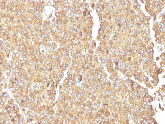 Anti-Chromogranin A antibody [LK2H10] used in IHC (Paraffin sections) (IHC-P). GTX34604