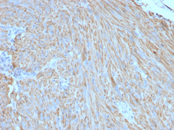 Anti-c-Kit antibody [C117/370] used in IHC (Paraffin sections) (IHC-P). GTX34606