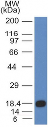 Anti-c-Kit antibody [KIT/983] used in Western Blot (WB). GTX34608