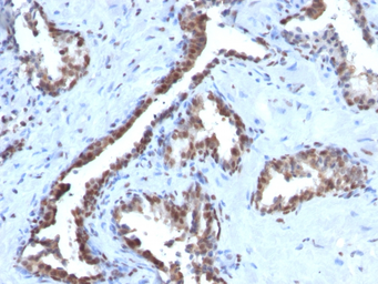 Anti-Cyclin B1 antibody [CCNB1/1098] used in IHC (Paraffin sections) (IHC-P). GTX34615
