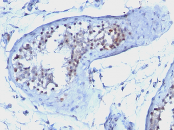 Anti-Cyclin B1 antibody [CCNB1/1098] used in IHC (Paraffin sections) (IHC-P). GTX34615