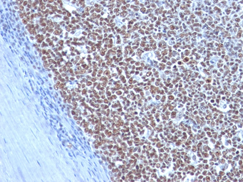 Anti-Cyclin B1 antibody [CCNB1/1098] used in IHC (Paraffin sections) (IHC-P). GTX34615