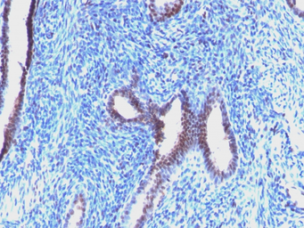 Anti-Cyclin B1 antibody [CCNB1/1098] used in IHC (Paraffin sections) (IHC-P). GTX34615