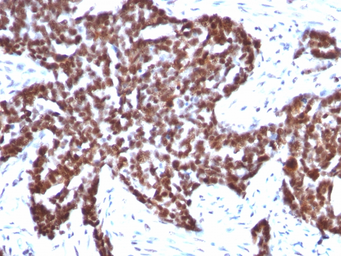 Anti-Cyclin B1 antibody [CCNB1/1098] used in IHC (Paraffin sections) (IHC-P). GTX34615