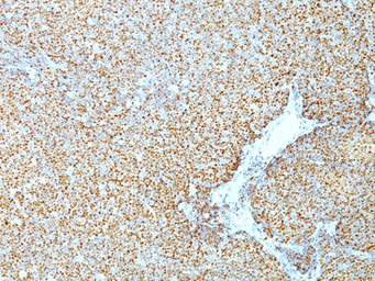 Anti-Cyclin D1 antibody [CCND1/809] used in IHC (Paraffin sections) (IHC-P). GTX34617