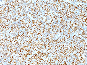 Anti-Cyclin D1 antibody [DCS-6] used in IHC (Paraffin sections) (IHC-P). GTX34618