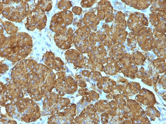 Anti-Cytochrome C antibody [CYCS/1010] used in IHC (Paraffin sections) (IHC-P). GTX34621