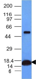 Anti-Cytochrome C antibody [CYCS/1010] used in Western Blot (WB). GTX34621