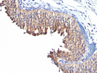 Anti-Cytokeratin 10 antibody [LH2] used in IHC (Paraffin sections) (IHC-P). GTX34623