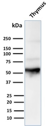 Anti-Cytokeratin 10 antibody [LH2] used in Western Blot (WB). GTX34623