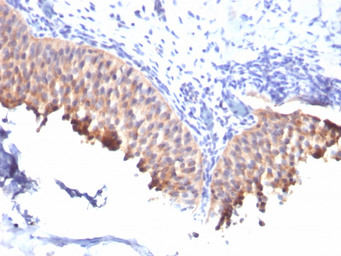Anti-Cytokeratin 10 antibody [SPM261] used in IHC (Paraffin sections) (IHC-P). GTX34624