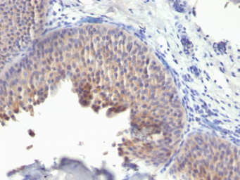 Anti-Cytokeratin 10 antibody [KRT10/1275] used in IHC (Paraffin sections) (IHC-P). GTX34628