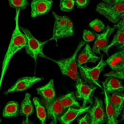 Anti-Cytokeratin 14 antibody [SPM263] used in Immunocytochemistry/ Immunofluorescence (ICC/IF). GTX34629