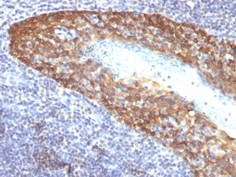 Anti-Cytokeratin 14 antibody [KRT14/532] used in IHC (Paraffin sections) (IHC-P). GTX34630