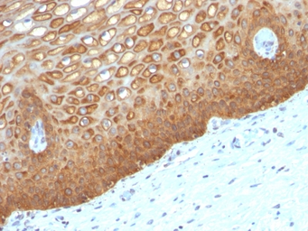 Anti-Cytokeratin 14 antibody [KRT14/532] used in IHC (Paraffin sections) (IHC-P). GTX34630