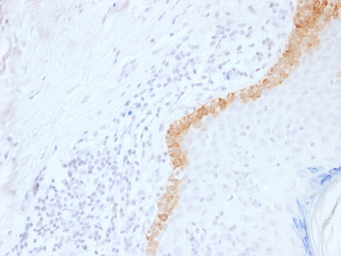 Anti-Cytokeratin 15 antibody [LHK15] used in IHC (Paraffin sections) (IHC-P). GTX34632