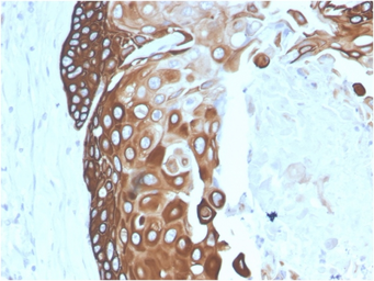 Anti-Cytokeratin 15 antibody [SPM190] used in IHC (Paraffin sections) (IHC-P). GTX34633