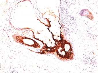 Anti-Cytokeratin 17 antibody [SPM560] used in IHC (Paraffin sections) (IHC-P). GTX34635