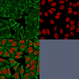 Anti-Cytokeratin 18 antibody [DE-K18] used in Immunocytochemistry/ Immunofluorescence (ICC/IF). GTX34641