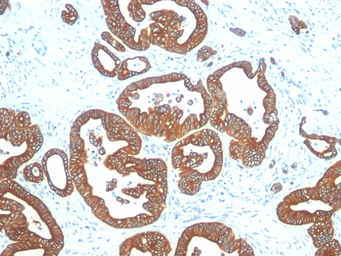 Anti-Cytokeratin 18 antibody [DE-K18] used in IHC (Paraffin sections) (IHC-P). GTX34641