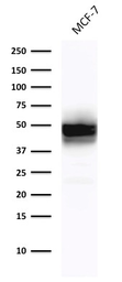 Anti-Cytokeratin 18 antibody [DE-K18] used in Western Blot (WB). GTX34641